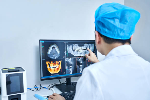 Best Emergency Root Canal Treatment in Reisterstown, MD
