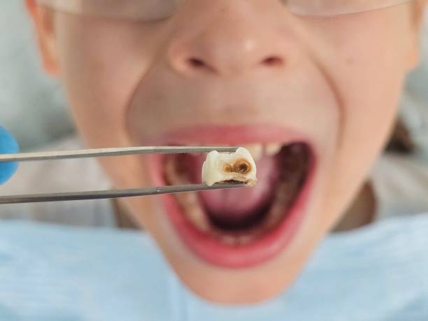 Best Weekend Emergency Dentist in Reisterstown, MD